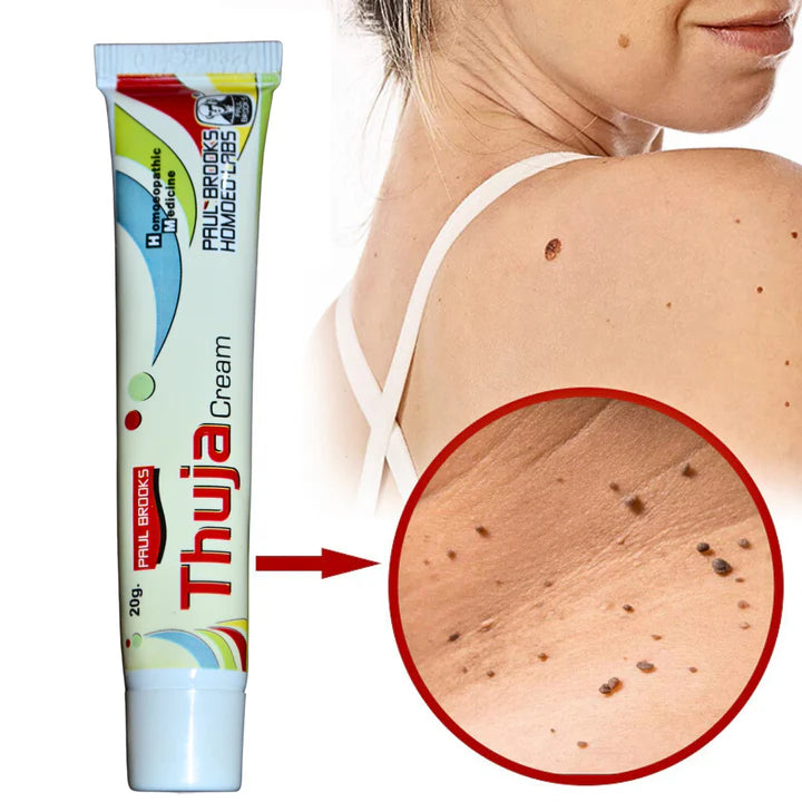 Thuja Cream – Natural Herbal Solution for Warts & Moles Removal