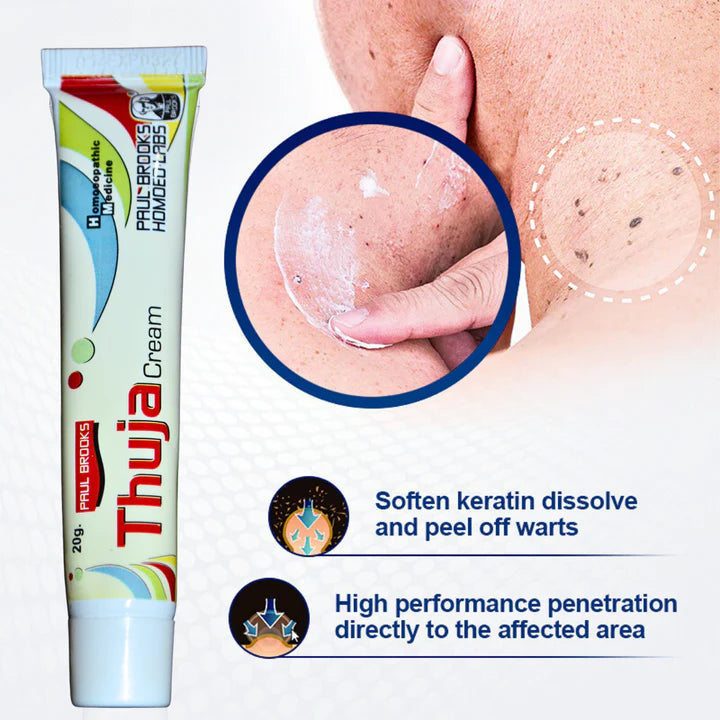 Thuja Cream – Natural Herbal Solution for Warts & Moles Removal