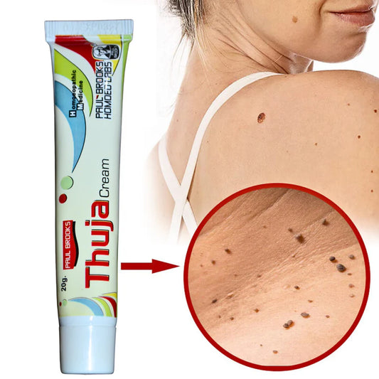 Thuja Cream – Natural Herbal Solution for Warts & Moles Removal